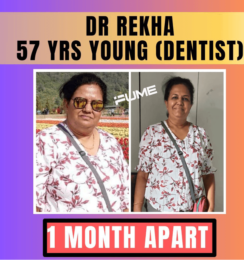 Rekha transformation